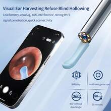 耳垢清除器 - 7 件套耳垢清除器套装 - 带摄像头的耳垢清除器 - 带照明的耳垢清除器 - 带 6 个耳垢铲的耳垢清除器 - 高清耳垢清除工具