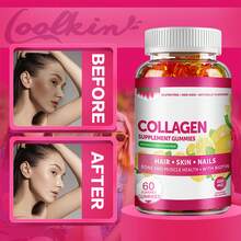 XEMENRY Collagen Supplement - Biotin, Vitamin C, Vitamin E - For Hair, Skin & Nails - 60pcs - One bottle - Trial stage - View 3