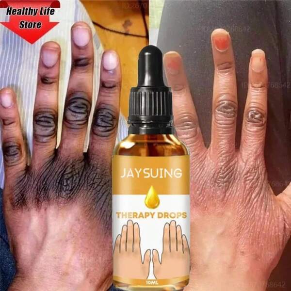 10ml Instant Brightening Serum For Dark , Elbows And Knees, Rapid Whitening And Stain Removal