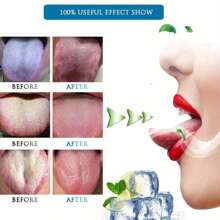 1/2 Pink Tongue Scraper, Tool For Cleaning Tongue Coating, Silicone Tongue Brush For Cleaning, Pink And Blue Tongue Coating Cleaning Scraper, Bad Breath Removal, Easy-To-Use Tongue Cleaner, Used For Cleaning And Refreshing Breath, Oral Care To Reduce Bad Breath, Adult Tongue Cleaner, Tongue Cleaning Tool