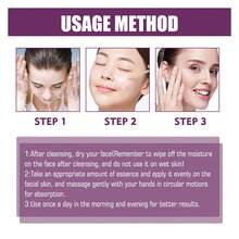 Niacinamide Serum, Skincare Lifting Spot-Blemishing And Anti-Wrinkle Serum - 彩色 - 查看 5