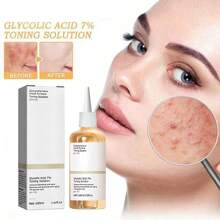 100ML Glycolic Acid 7% Toner,Glycolic Sour 7% Toning, Facial Exfoliation Astringe Pores, Solution For Blemishes And Acne, Rejuvenate Your Skin(3.38 Fl.Oz)