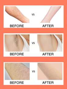 Máy cạo lông nữ, thích hợp cho vùng nách, chân và bikini, máy cạo lông cầm tay màu hồng, dao cạo lông bikini cầm tay 5 lưỡi, lưỡi dao thay thế bằng thép không gỉ, đầu cạo màu hồng, quà tặng thiết yếu cho bé gái khi đi du lịch, thích hợp cho bãi biển, kỳ nghỉ, du lịch, công tác. - Nhiều màu - Xem 5