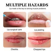 Hoygi Moisturizing Lip Mask Moisturizing Light Lip Lines Anti-Drying Lips Smooth Non-Greasy Lip Mask - Nhiều màu - Xem 3
