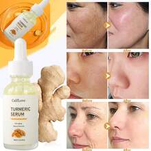 Turmeric Face Serum – Brightening & Hydrating Essence With Anti-Wrinkle, Firming, Dark Spot & Fine Line Care For Glowing Skin 30ml/1pcs - Green - View 5