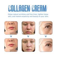 Hoygi Collagen Cream Fades Fine Lines, Nasolabial Folds, Makes Skin Look Healthier, Moisturizes And Anti-Aging Cream - 彩色 - 查看 3