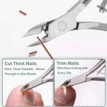 AIRCUN Professional Nail Trimming Kit With Stainless Steel Tools, Multi-Function Dead Skin Remover For Ingrown Toenails, Hangnails, Calluses, And Paronychia, Ergonomic Handle Design With Nail File & Cuttle Pusher (White/Blue)