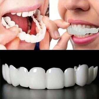 1pc Comfortable And Snug Set Of Cosmetic Dentures, Including Upper And Lower Teeth, Providing A Confident And Smiling Experience. The Veneered Dentures Bring A Brilliant Smile