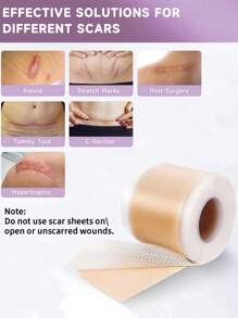 Nastro per coprire le cicatrici, traspirante e flessibile, adesivo per cicatrici invisibile beige chiaro, adatto per cicatrici chirurgiche, iperplastiche, post-partum e da ustioni, copertura invisibile per grandi aree di collo e corpo (impermeabile)