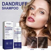 临床强效去屑洗发水 3.38 液体盎司 | 72 小时去屑防御 + 舒缓头皮护理 - 彩色 - 查看 3