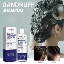 临床强效去屑洗发水 3.38 液体盎司 | 72 小时去屑防御 + 舒缓头皮护理 - 彩色 - 查看 2