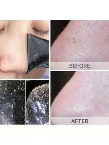 10pcs Deep Pore Cleansing Nose Strips, Blackhead Remover Pore Strips For Oily Skin, Instantly Unclog Pores - Multicolor - View 4
