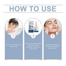 The Acne Cleansing Essence Gently Nourishes The Facial Skin, Tightens And Refines Pores, And Is An Acne-Removing Essence - Màu xanh nhạt - Xem 6