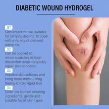 OUHOE Skin Care Gel Gentle Ingredients Moisturize Body Skin Relieve Discomfort Body Care Gel - 1 - 查看 2