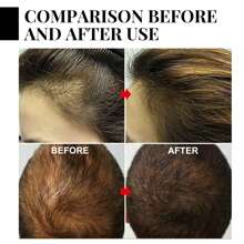 La lacca per capelli Batana da 2 pezzi può idratare e riparare in profondità i capelli, rendendoli forti