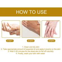 50ml Black Skin Exfoliating Oil, For Knees, Elbows, Armpits And Joints, Skin Brightening - 50ml - View 6