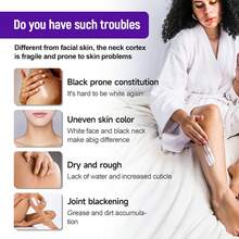 ​SUMAX Underarm Brightening Cream 50g/1.76oz - Niacinamide & Mulberry Extract Formula, Visibly Reduces Dark Elbows/Knees, Improves Skin Tone Evenness, Gentle Exfoliation For Body Care, Hypoallergenic - White - View 6