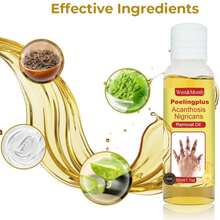 50ml Black Skin Exfoliating Oil, For Knees, Elbows, Armpits And Joints, Skin Brightening - 50ml - View 5