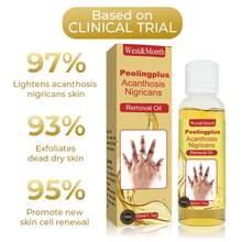 50ml Black Skin Exfoliating Oil, For Knees, Elbows, Armpits And Joints, Skin Brightening - 50ml - View 7