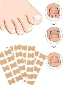 200 pezzi di toppe per la cura delle unghie dei piedi, toppe in tessuto non tessuto per unghie spesse, protezione spessa per unghie incarnite e spesse - cura dei piedi, delle mani e delle unghie.