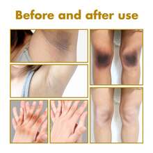 50ml Black Skin Exfoliating Oil, For Knees, Elbows, Armpits And Joints, Skin Brightening - 50ml - View 2