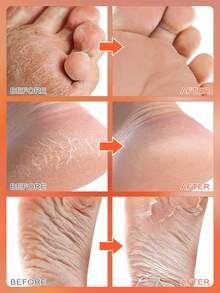 4 件 = 2 对保湿足部去角质膜滋养皮肤和足部护理烟酰胺足膜去角质足部去角质膜用于皮肤再生和足部护理干裂