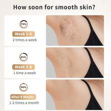 Painless Hair Removal Device With Cooling Function, 999,900 Light Pulses, 9-Level Intelligent Energy Regulation, Painless Hair Removal, Unisex, For Home Use, Suitable As A Christmas Gift. - EU C Type Plug(220-240V) - View 4