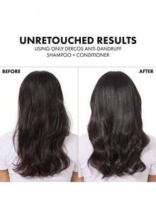 Vic Dercos Shampoo Tratamiento Anticaspa 2025 - Fórmula Intensiva para Cabello Seco con Ácido Salicílico que Elimina la Caspa desde la Primera Aplicación - Kit de 200ml con Tecnología Pro-Keratin - Regalo Exclusivo de San Valentín para el Cuidado Capilar - TOP en Productos para Cabello con Caspa y Picazón - Blanco - Ver 2