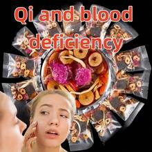 150g Mixed Tea, Cinnamon Red Dates And Goji Berry Tea, Brown Sugar Goji Berry And Date Tea, Suitable For Women; Menstruation; Stay Up Late, Iron Supplement; With Goji Berries, Longan, Red Dates, Ginger; Creative Holiday Gift Ideas; Send Health To Family Members - Apricot - View 7