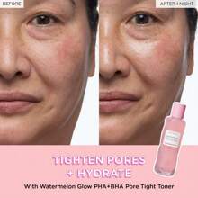 Hydrating Milky Toner - Dewy, Ultra Hydrating Toner For Face - Soothes Skin, Locks In Moisture, Reduces Redness - Barrier Repair - Cranberry Extract And Rice Toner - Hydrating Milky Brightening Tonic For Glowing Skin.