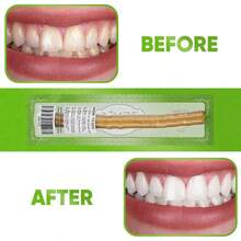 Zenia Sewak Natural Miswak Toothbrush - Vacuum Sealed Natural Flavor Traditional Peelu Toothbrush Stick - For Healthy Gums, Teeth, And Fresher Breath (Pack Of 1) Back To School - 1 - View 6