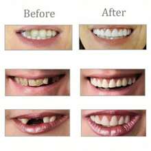 Set de 4 piezas de nuevos soportes dentales mejorados, sin poros, superior e inferior, dentaduras postizas simuladas, decoración de dientes de sonrisa perfecta