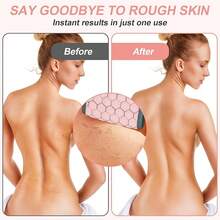 Exfoliating Back Scrubber For Shower, Double-Sided Back Scrub Washcloth With Handles For Use In Shower, 38 Inches Body Exfoliator Bath Tool To Clean Your Body Deeply For Men & Women Skin Care - 粉色 - 查看 5