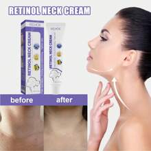 Creme para Pescoço com Retinol 40g - 14 Dias para Pescoço de Cisne! Reduz Visivelmente Rugas + Ilumina Opacidade com Aumento Firmador de Colágeno