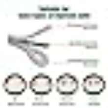 Titanium Ingrown Toenail CorrectorNail Repair Tools Ingrown Toenail Treatment Suitable For Most People With Ingrown Toenails Ingrown Toenail Removal Kit Designed For Ingrown Toenail Repair 10pcs - as pic - View 5