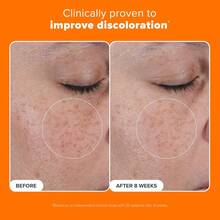 护肤身体精油精华，面部及身体保湿霜，富含维生素E和A，适用于疤痕、妊娠纹、敏感肌肤及所有肤质。 - 彩色 - 查看 2