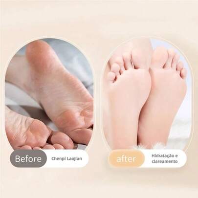 2 Pcs Meias De Silicone Para O Cuidado Dos Pés Gel Hidratante Anti-Rachaduras Removedor De Pele Morta