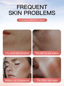 خليط 5/6/10/15 قطعة قناع زهري، مبيض، مرطب ومرطب، محكم وملطف للتجاعيد، يقلل من جفاف الوجه، يحتوي على استخلاص الزهور بغزارة، يجعل البشرة أكثر نعومة وإشراقًا