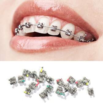 20Pcs/Set Dental Corrector Metal Monomer Mini Ross MBT Hook Dental Treatment Material Set(Random Color And Style)