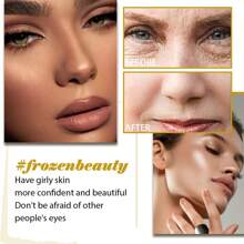 Bee Essence, Anti-Aging And Firming, Reduces Fine Lines And Nasolabial Folds, Repairs Dullness, Moisturizes And Tightens The Skin Care Essence