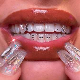 20pcs Y2K Butterfly Shape Champagne Gold Sparkly DIY Dental Grillz Set, Rhinestone Decor Teeth Accessories, Cute Dazzling Style Fashion Tooth Jewelry For Daily, Party, Gift (Excluding Glue)