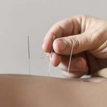 Acupuncture Needle 100 Needles Uniqmed Blister Individual Systemic Anvisa Sterilized - 0.25x30 - 查看 4
