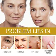 Bee Essence, Anti-Aging And Firming, Reduces Fine Lines And Nasolabial Folds, Repairs Dullness, Moisturizes And Tightens The Skin Care Essence