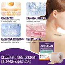 1pc Scar Repair Patch, Silicone Gel Technology, Strong Faded Old Scars, Waterproof For Bathing, Suitable For Children And Adults