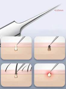 1 pieza Pinzas quitaespinillas y puntos negros de acero inoxidable - Herramienta antiacné sin fragancia, apta para cara y nariz, adecuada para piel normal - Herramienta profesional de cuidado facial para puntos blancos y negros