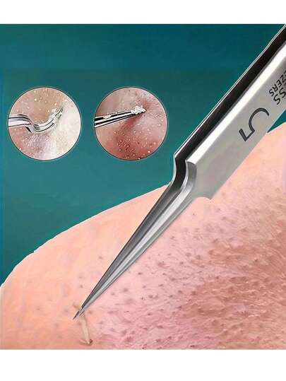 1pc Stainless Steel Blackhead & Pimple Remover Tweezers - Fragrance-Free Acne Tool, Suitable For Face & Nose, Suitable For Normal Skin Type - Professional Facial Care Tool For Whiteheads & Blackheads