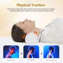 Cervical And Roll Neck Pillow,2 In 1 Removable Ergonomic For Pain Relief,Support For Sleeping,Memory Foam For Side, Back & Stomach Sleepers - White - View 6