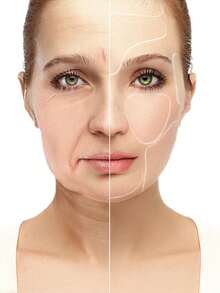 Patchs réutilisables en silicone pour le visage, le cou et la poitrine pour lisser et anti-rides, convenant à une utilisation nocturne sur la poitrine et le cou, réutilisables, rend la peau plus lisse, illumine votre peau, réduit les signes du vieillissement pour les femmes et les filles, soins de la peau, outil de soins de la peau, patch anti-rides - Transparent - Voir 8