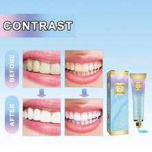 2Pcs Niacinamide Whitening Toothpaste, Fresh Breath Niacinamide Whitening Toothpaste,Nicotinamide Dazzle White Toothpaste, Remove Tooth Stains Complete Care Toothpaste, Stain Removal Toothpaste Natural,Repair And Protect Teeth - Blue - View 7