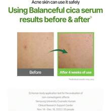 Torriden Balanceful Serum Centella Asiatica Extract 50ml - 1 - View 3